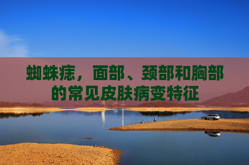 蜘蛛痣，面部、颈部和胸部的常见皮肤病变特征