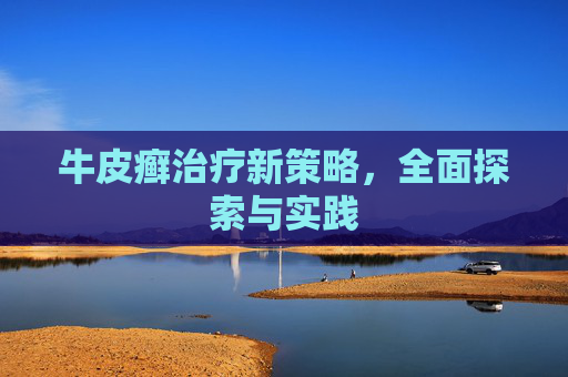 牛皮癣治疗新策略，全面探索与实践