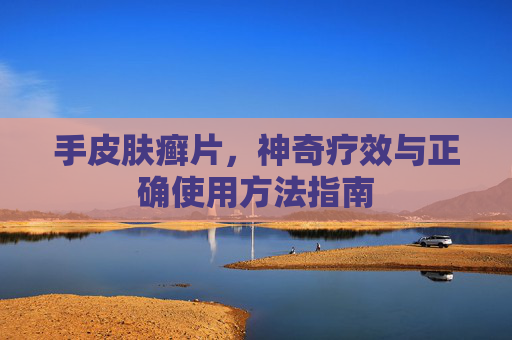 手皮肤癣片,神奇疗效与正确使用方法指南 手皮肤癣片,神奇疗效与正确使用方法指南