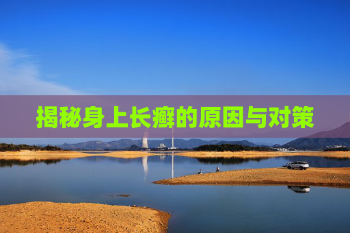 揭秘身上长癣的原因与对策 揭秘身上长癣的原因与对策